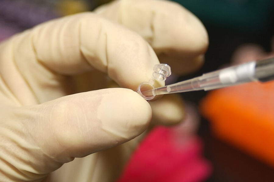 DNA sample